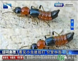 隱翅蟲有毒嗎？隱翅蟲會毀容嗎？