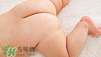 尿布疹怎么辦？寶寶尿布疹擦什么藥好？