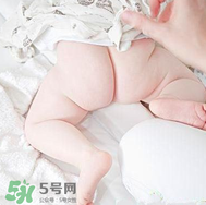 尿布疹和濕疹的區(qū)別 尿布疹和濕疹如何區(qū)分？