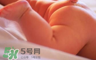 寶寶尿布疹可以擦紅霉素軟膏嗎？紅霉素軟膏對(duì)尿布疹有效嗎？