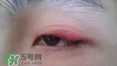 長(zhǎng)期用假睫毛雙眼皮貼對(duì)眼睛有什么傷害？