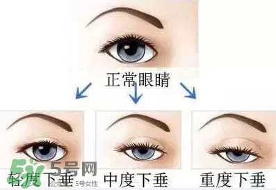 長(zhǎng)期用假睫毛雙眼皮貼對(duì)眼睛有什么傷害？
