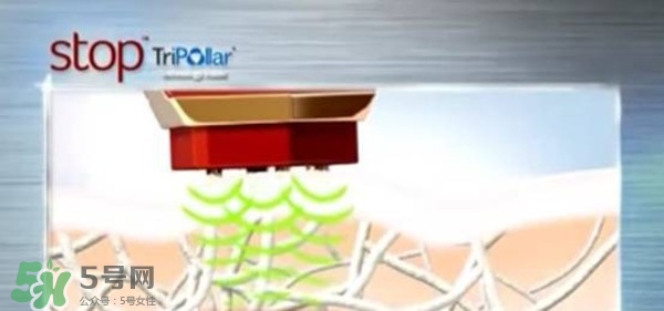 tripollar stop怎么樣？tripollar pose好用嗎