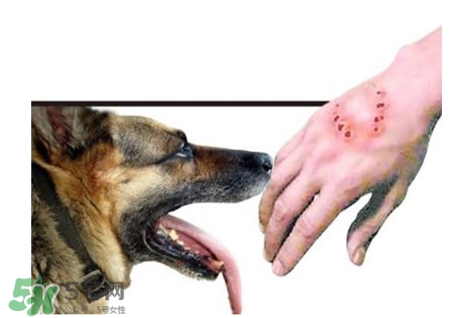 狂犬病會傳染嗎？狂犬病會學(xué)狗叫嗎