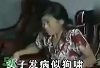 狂犬病能治好嗎？狂犬病的早期癥狀