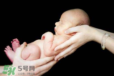 寶寶臍帶掉了要緊嗎？寶寶臍帶掉了出血了怎么辦？
