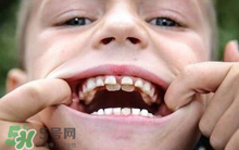 兒童換牙可以吃鈣片嗎?兒童換牙吃什么好？