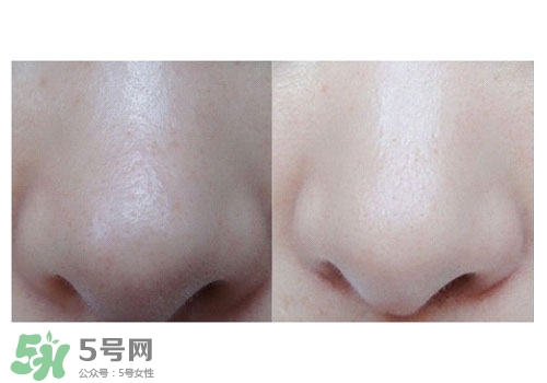 碧柔鼻貼白色和黑色哪個(gè)好？碧柔鼻貼黑白區(qū)別
