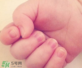 寶寶指甲凹凸不平是什么原因？寶寶指甲凹凸不平正常嗎？