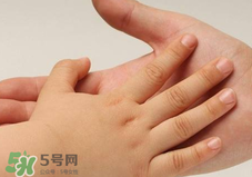 寶寶指甲凹凸不平是什么原因？寶寶指甲凹凸不平正常嗎？