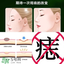 藥水點痣和激光點痣哪個好？各有什么優(yōu)缺點