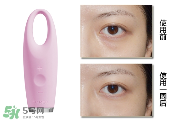 foreo眼部按摩儀好用嗎？foreo iris眼部按摩儀副作用