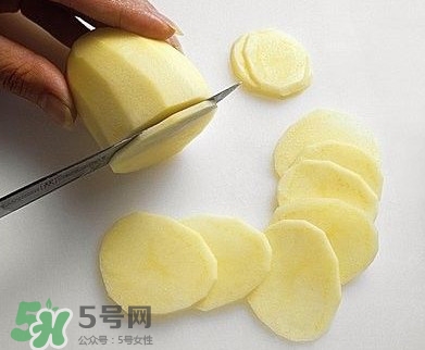 馬鈴薯能去痘印嗎？馬鈴薯可以祛痘??？