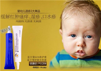 恩姆花園濕疹膏有激素嗎？恩姆花園濕疹膏含不含激素？