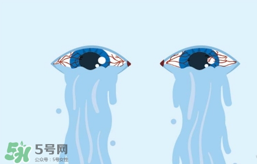 眼藥水可以兩個(gè)人用嗎？眼藥水可以共用嗎？