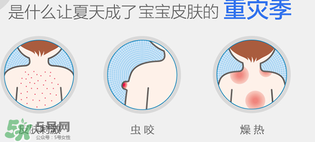 妙思樂爽膚水好用嗎？妙思樂爽膚水能去痱嗎？
