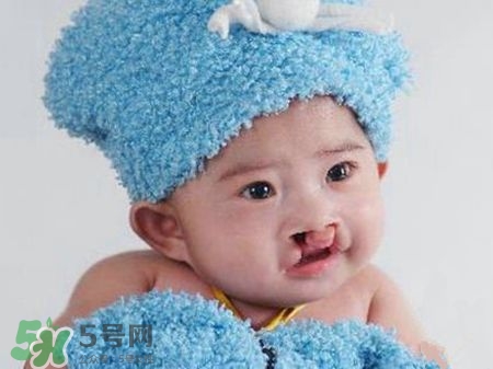 兔唇可以治嗎？兔唇修補術