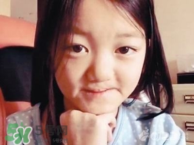 兔唇是什么？兔唇是什么原因造成的？