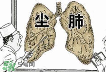 一般幾年時(shí)間會(huì)有塵肺病？塵肺病的早期癥狀