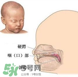 兔唇能檢查出來嗎？兔唇能完全修復(fù)嗎？