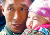 兔唇是什么？兔唇是什么原因造成的？