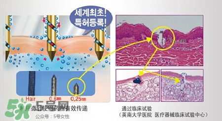 珠兒麗蚊子針好用嗎？珠兒麗蚊子針副作用