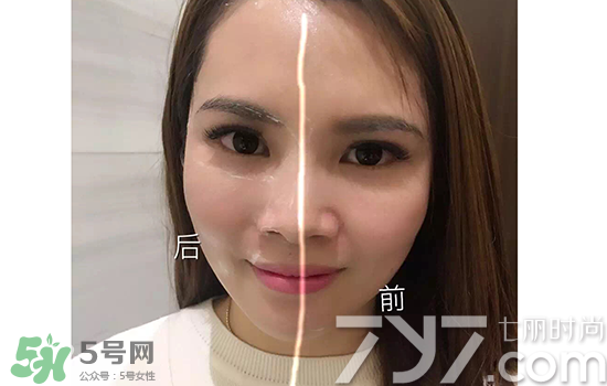 黃金棒有什么用？黃金棒的功效與作用