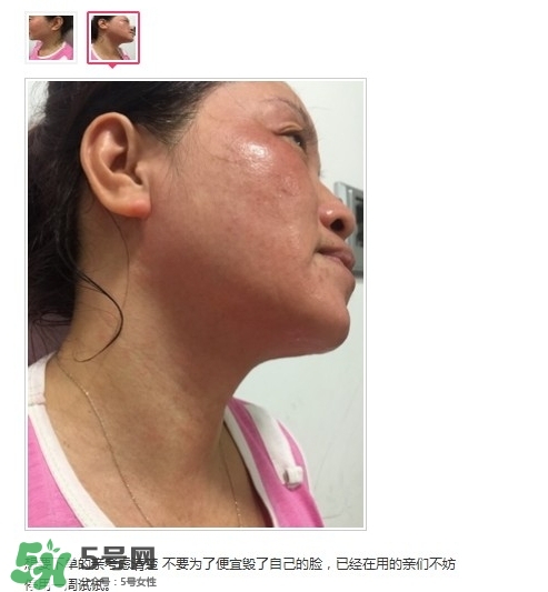 肌膚之食是什么牌子？肌膚之食讓我毀容了