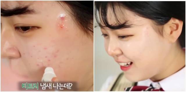 real skin patch怎么樣？real skin是什么牌子
