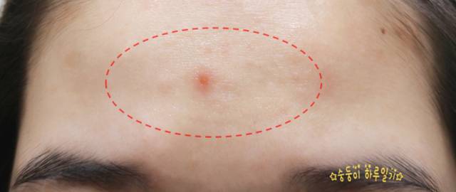 real skin patch怎么樣？real skin是什么牌子