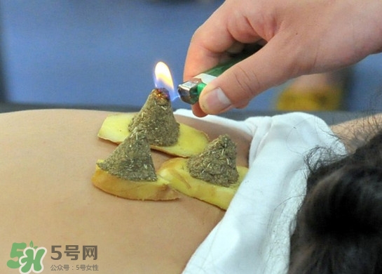 三伏灸灸哪里？三伏灸是每天都灸嗎