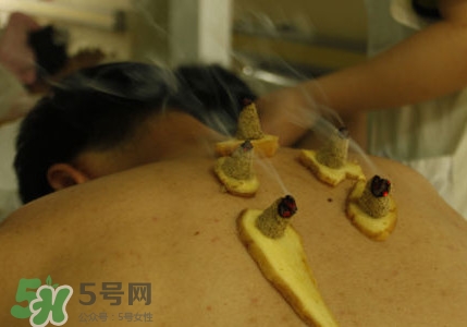 三伏灸有用嗎？2017年三伏艾灸時(shí)間