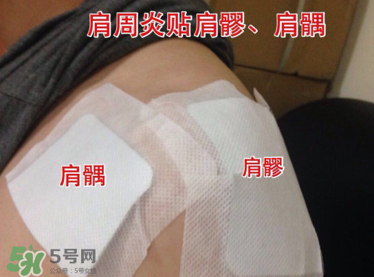 艾灸貼多少錢一盒?？艾灸貼一盒60裝多少錢？