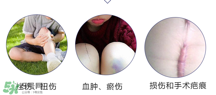 hirudoid除疤膏有效嗎？hirudoid去疤膏效果如何？