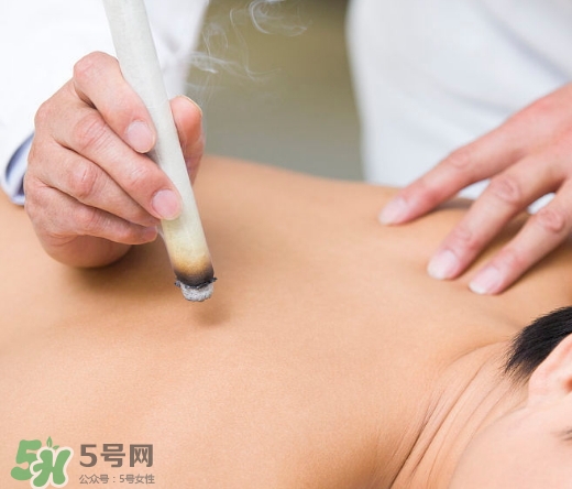 三伏貼和艾灸哪個好？三伏貼和艾灸區(qū)別