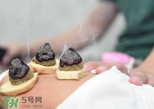 三伏灸什么人不能做？三伏灸適合哪些人？