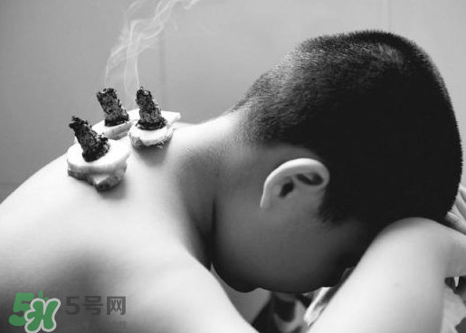 三伏灸什么人不能做？三伏灸適合哪些人？
