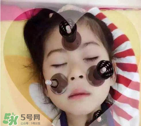 艾灸貼可以治咳嗽嗎？艾灸貼可以治退燒嗎？