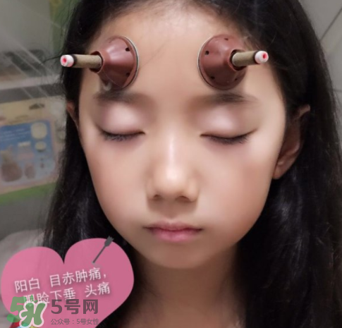 艾灸貼可以治咳嗽嗎？艾灸貼可以治退燒嗎？