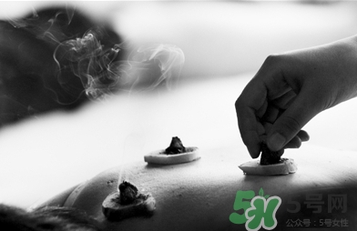 三伏灸什么時(shí)候開始灸？三伏灸怎么灸？