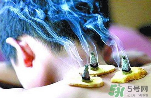 三伏灸什么時(shí)候開始灸？三伏灸怎么灸？