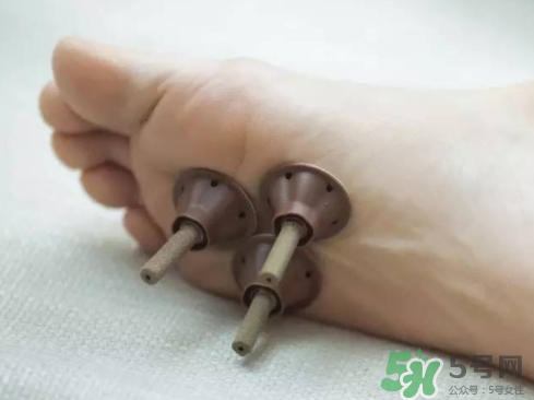 艾艾貼灸出水珠為什么？艾艾貼后有水珠要擦嗎？