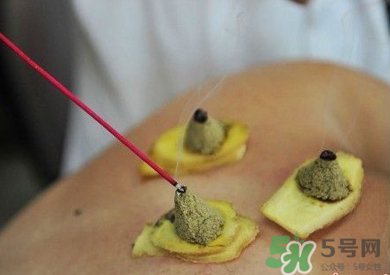 三伏灸可以自己灸嗎？三伏灸可以在家做嗎？