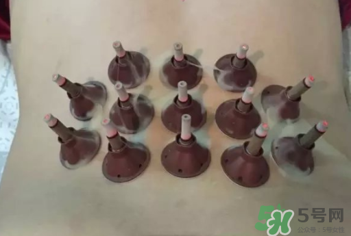 艾艾貼可以貼肚臍眼嗎？艾艾貼貼肚臍有什么作用？