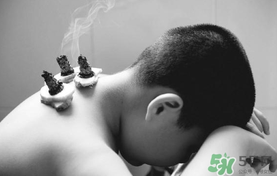 三伏灸要灸幾次？三伏灸要灸多久？