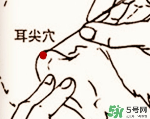 什么人不能做放血療法？放血療法有什么功效？
