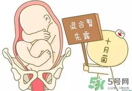 胎位不正能順產(chǎn)嗎？胎位不正怎么辦？