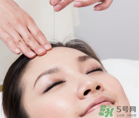 中醫(yī)院針灸一次多少錢(qián)？針灸后疼痛加重正常嗎