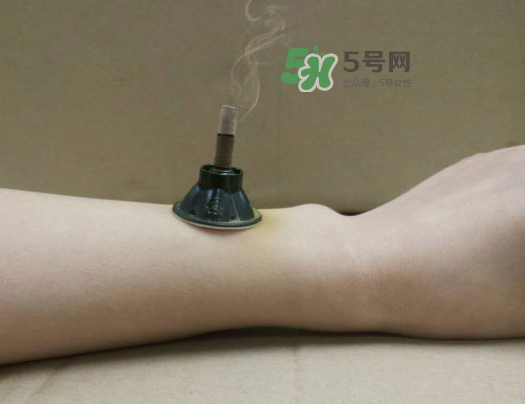 三伏天下雨可以艾灸嗎？三伏天下雨艾灸好嗎？