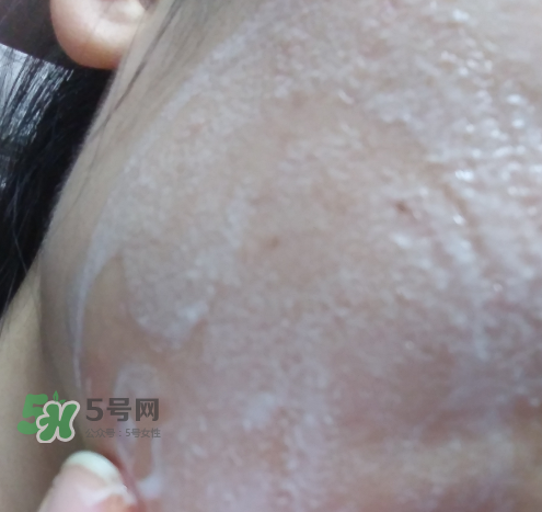 貝蜜清凈痘控油潔面啫喱怎么樣？貝蜜清祛痘控油潔面啫喱好用嗎？